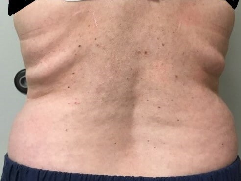 Before Image
