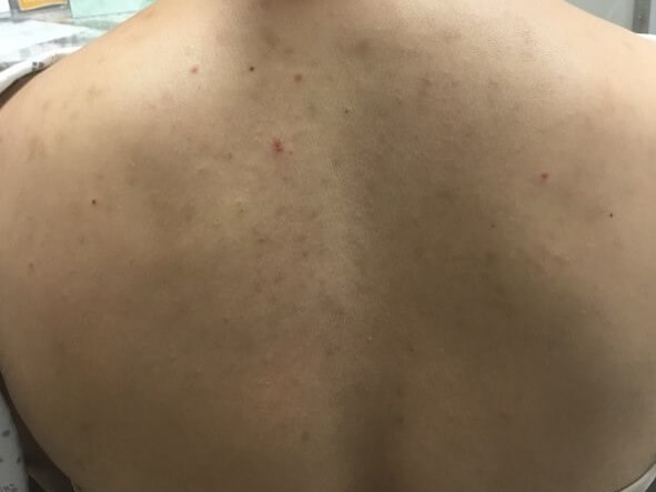 Before Image