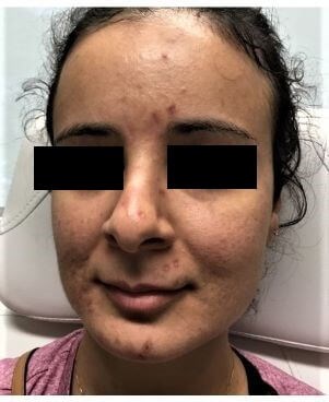 Before Image