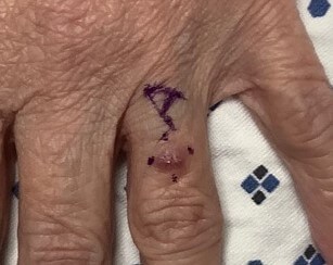 Before Image