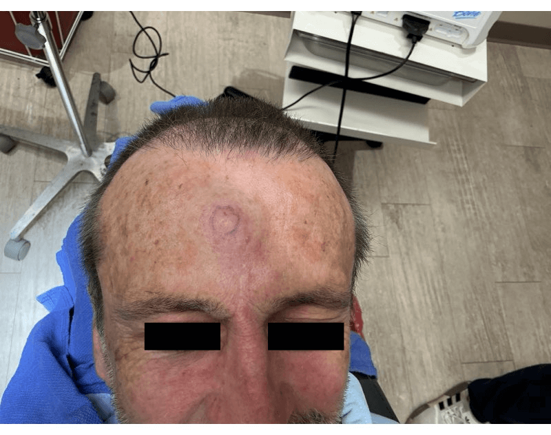 After Image