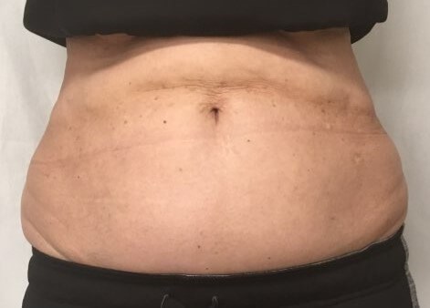 After Image