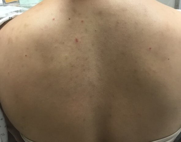 Before Image