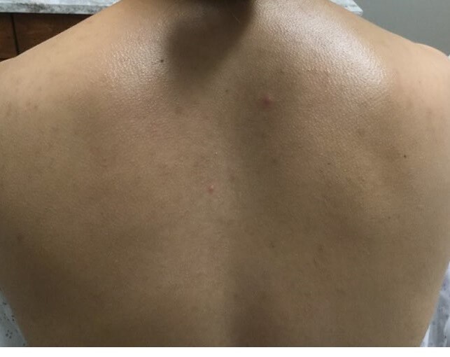 After Image