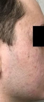 Before Image