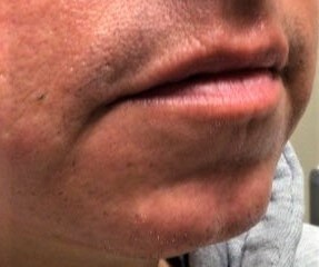 Before Image