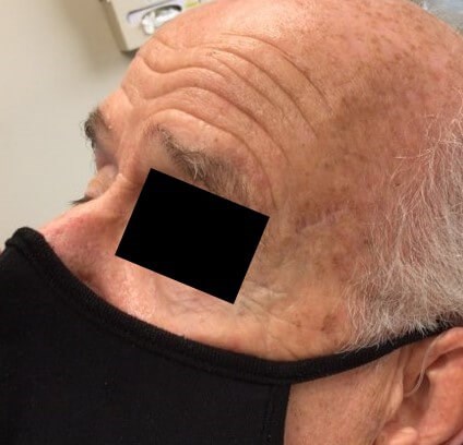 After Image