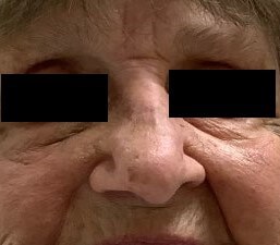 After Image