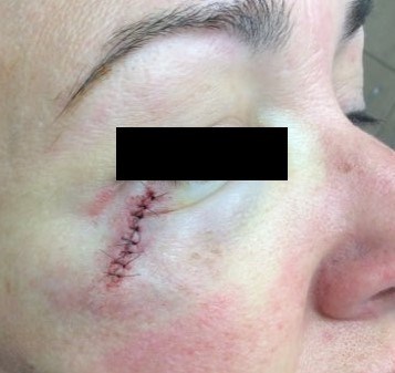 Before Image