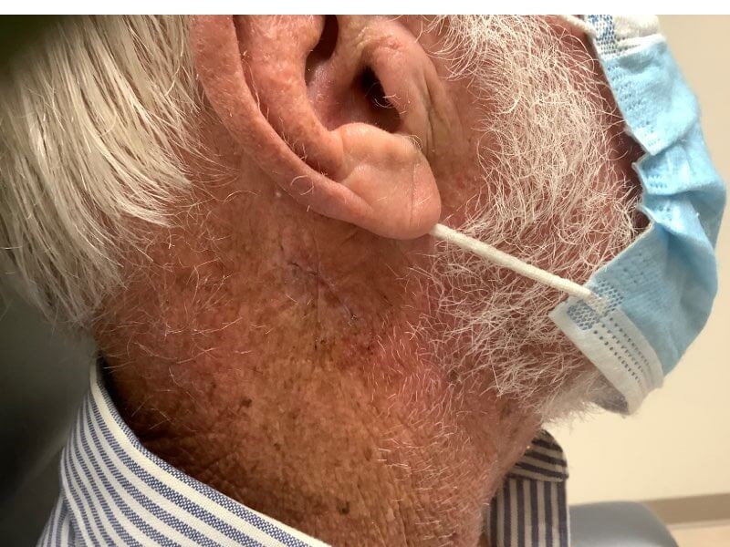 Complex Repair After