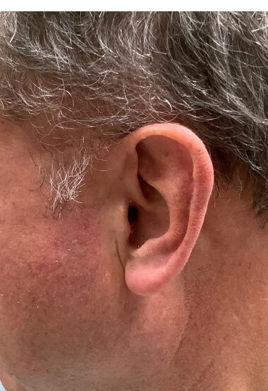 After Image
